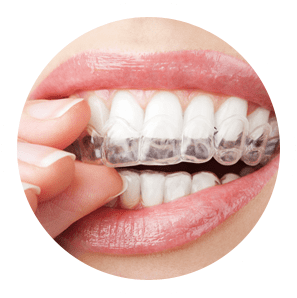 INVISIBLE BRACES INVISIBLE BRACES