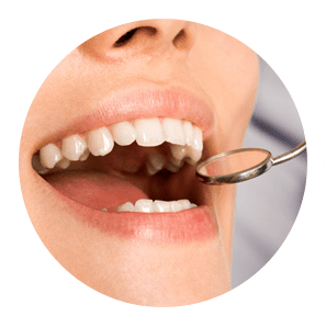 Wisdom Teeth Removal Sydney