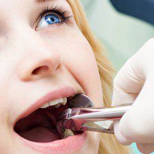 Deciding between Tooth Repair and Going for Dental Implants