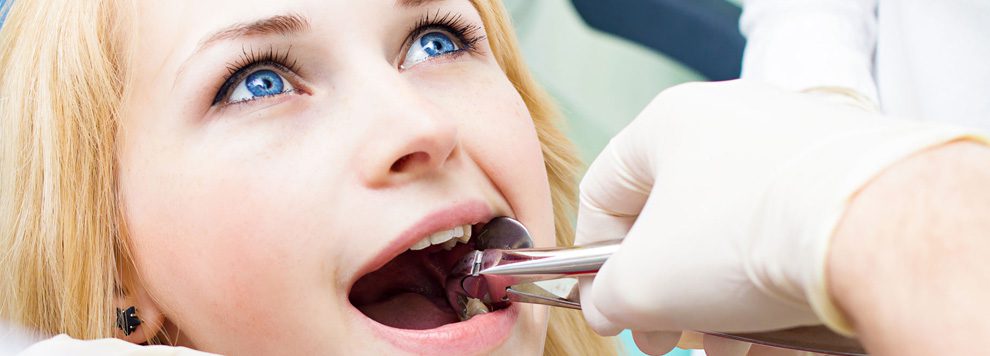 Deciding between Tooth Repair and Going for Dental Implants