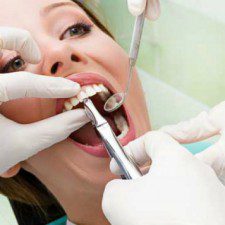 Factors that Affect Cost of Wisdom teeth Removal