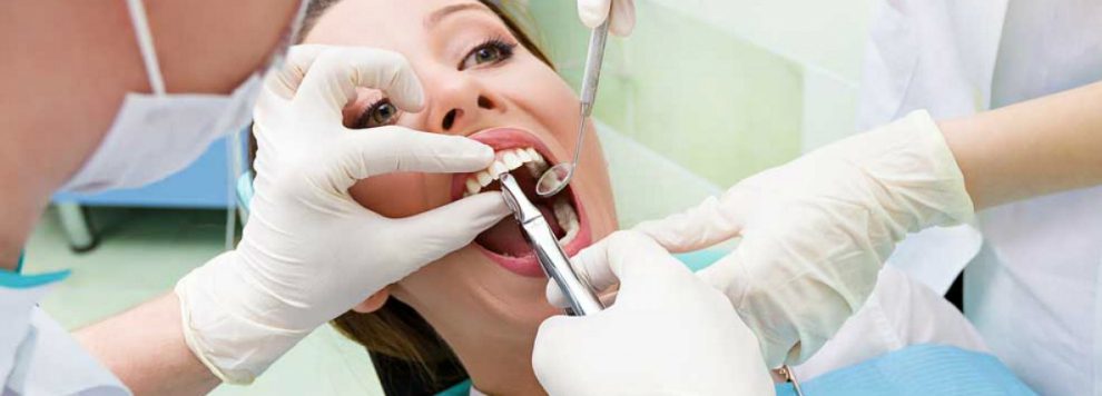 Factors that Affect Cost of Wisdom teeth Removal