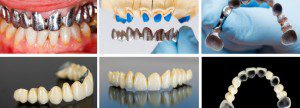 Denture Function