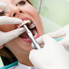 Wisdom Teeth Extraction Costs Wisdom Teeth Extraction Costs