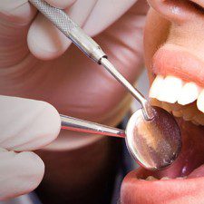 Wisdom Teeth Removal – All the Fundamental Facts You Should Know