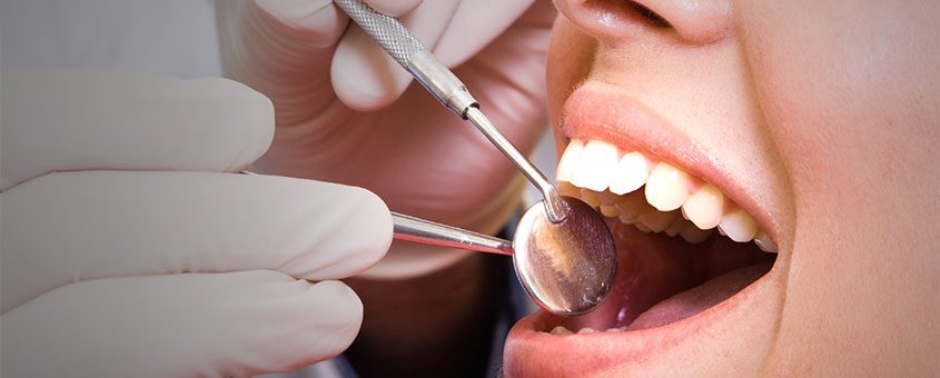 Wisdom Teeth Removal – All the Fundamental Facts You Should Know