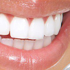 Know about your pearly white