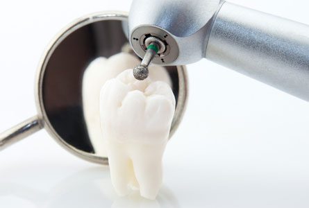 Wisdom Teeth Removal Recovery Tips