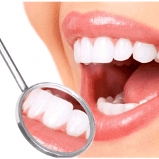 dental implants