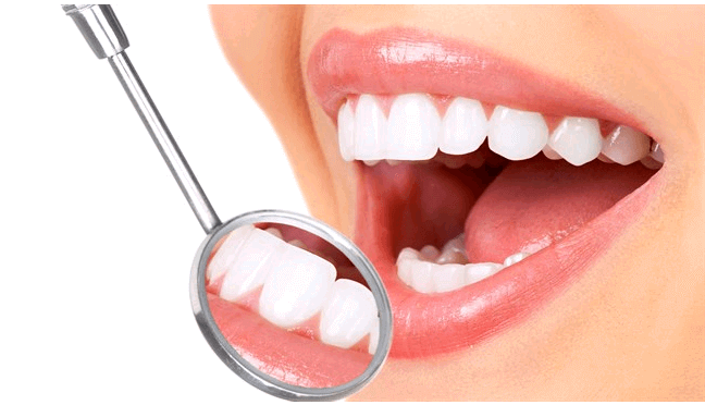 dental implants