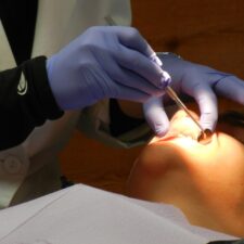 What does an Emergency Dentist do?