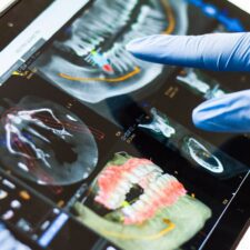 Is Wisdom Teeth Removal Mandatory? Here’s Your Answer Is Wisdom Teeth Removal Mandatory? Here’s Your Answer