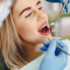 tooth implants in Sydney