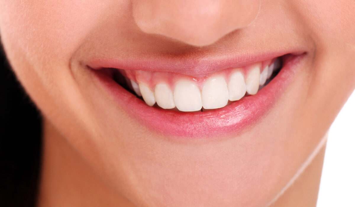 cheap dental implants in Sydney