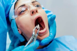 wisdom teeth removal sydney