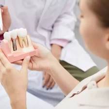 Dental Implant Procedure