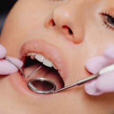 Dental Implants Sydney