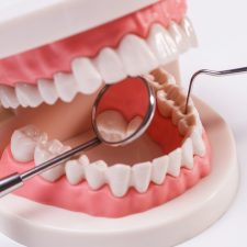 dental implants Sydney