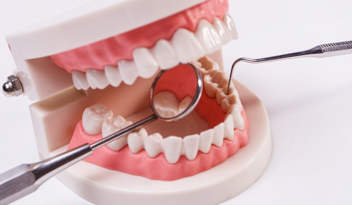 dental implants Sydney