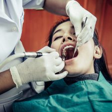 Wisdom teeth removal Sydney