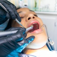 wisdom teeth removal - dr paulo pinho oral surgery clinic - sydney