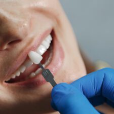 Dentist performing Zirconia implants procedure on a woman for natural and metal-free dental restoration
