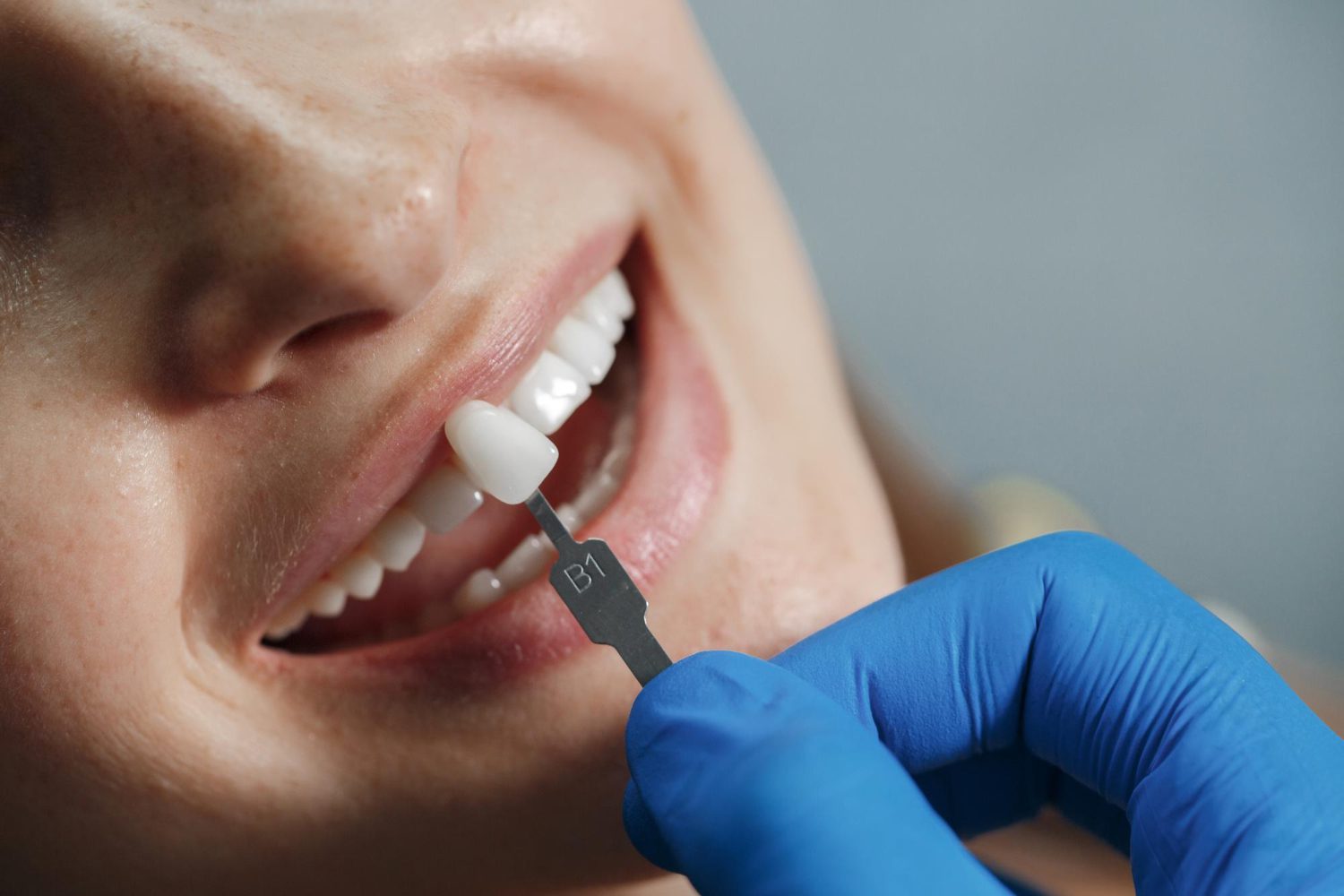 Dentist performing Zirconia implants procedure on a woman for natural and metal-free dental restoration