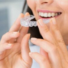 Invisible braces treatment for straightening crooked teeth