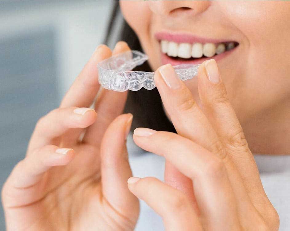 Invisible braces treatment for straightening crooked teeth