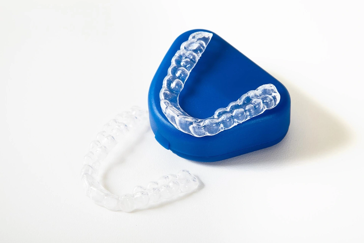 Dental implants in Sydney with custom whitening trays for a brighter smile